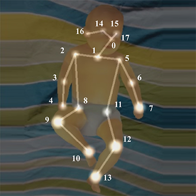 Cerebral Palsy Prediction with Frequency Attention Informed Graph Convolutional Networks