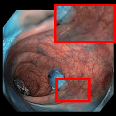 Depth-Aware Endoscopic Video Inpainting